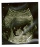 my babies first scan at 12wks old