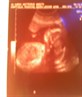 My lil niece 2ndscan!