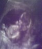 My lil niece 1st scan!