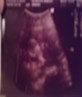 this is the first scan of m y baby