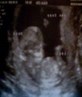 me lil baby