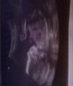 My second scan picture x