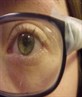 my eye and glasses...my glasses are broken
