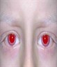 My eyes