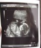 My baby boy! 19 weeks and 4 days