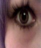 my eye