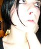 Bleeding nose? Oh no!