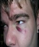 My Shiner!! aint it purty??