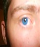 Bright blue eyes