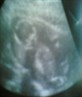 Latest Scan of Baby Due Aug 06