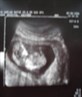 My Baby