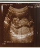 Our baby at 12 weeks 4 days x