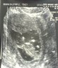 My nephew-to-be