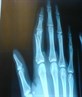 wen i snapped my finger