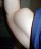 arm