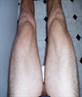 Legs