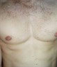 Chest