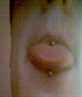 tongue bar