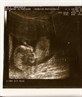 my 12 week scan