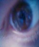 eye