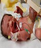 baby in ICU at leeds hospital