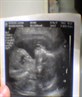 my baby