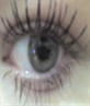 My Eye!!!