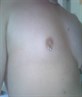 My Nipple