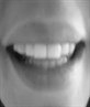 white smile