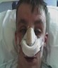 another1 of me after ma operation lol
