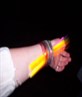 my arm