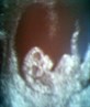 thats the 3rd babys 1st scan's