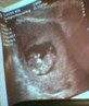 my baby