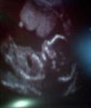 my baby girl at 20 week scan
