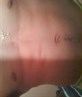 my body
