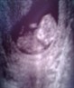 First scan of my baby! gorgeous!!!!