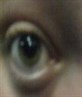 My Eye!!