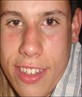 the face ov totton