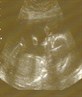 Our baby boy