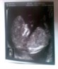 baby scan 2