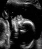 My Son Austin Who Is Due April 12th 2008