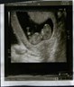 my 1st scan