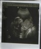 my baby