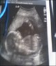 My 20 weeks scan of my baby girl
