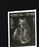 19 n a half week scan