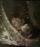 my 9week and 6 day scan pic on 25th march 08