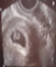 my baby