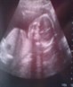 Baby Kiera 22 weeks
