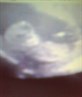 my 12 weeks 2 day scan lol