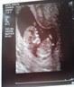 my baby which is cumming around april 8th